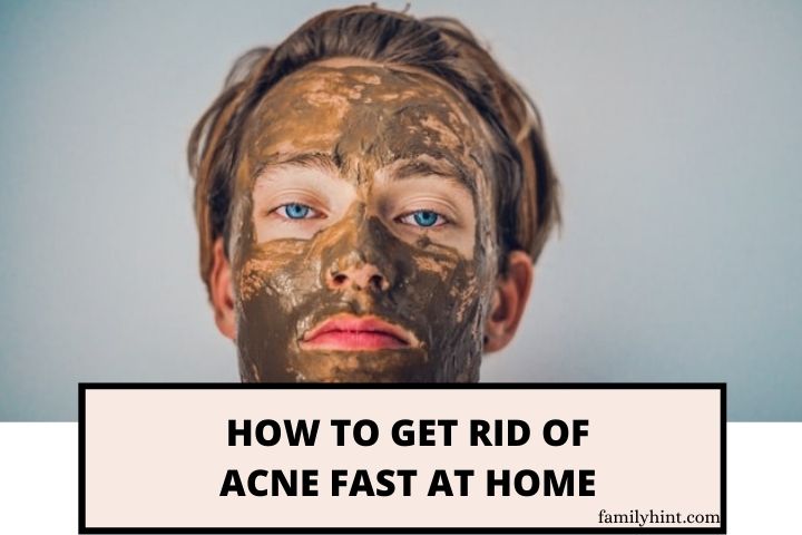 How to Get Rid of Acne Fast at Home