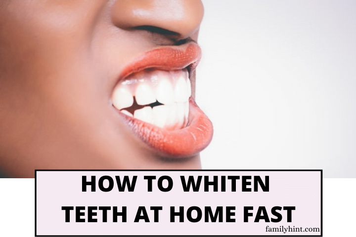 How to Whiten Teeth at Home Fast