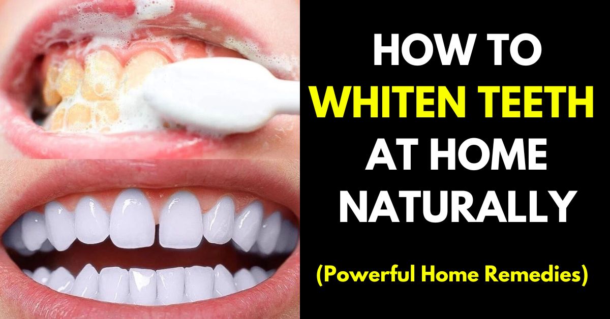 How to white your teeth at home