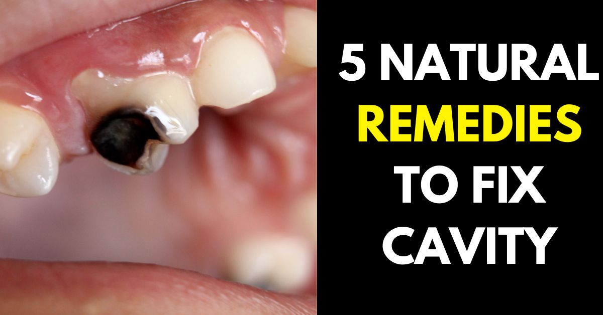 REMEDIES FOR CAVITY