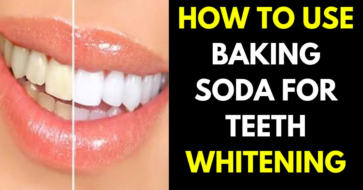 baking soda for teeth whitening