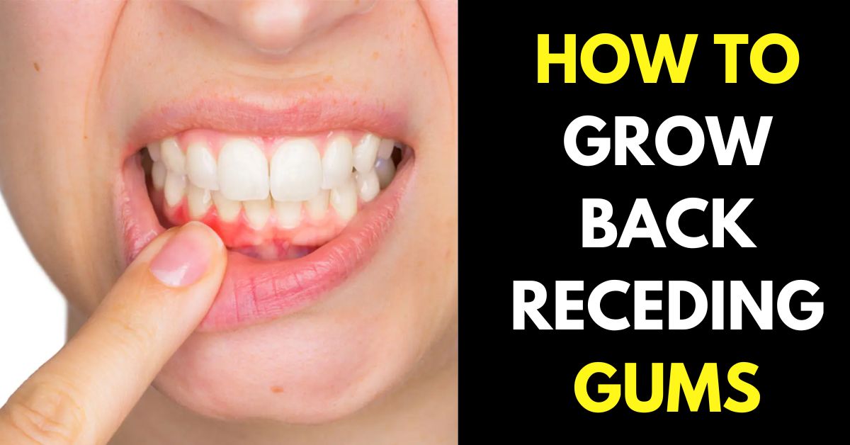 How to Grow Back Receding Gums