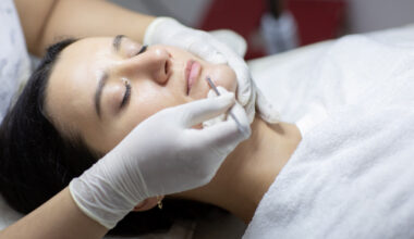 what are facial extractions